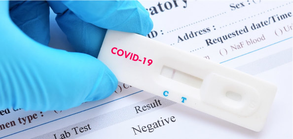 Covid 19 test