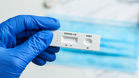 Antigen Test