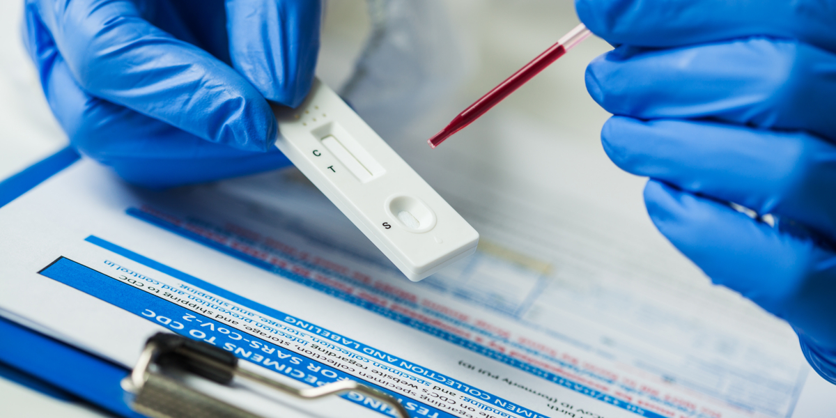 How Do Covid-19 Antibody Tests Differ From Diagnostic Tests?